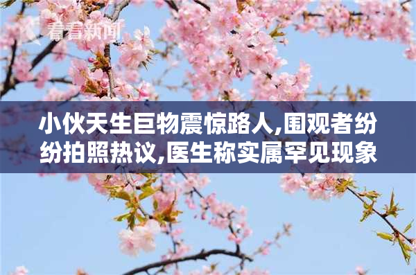 小伙天生巨物震惊路人,围观者纷纷拍照热议,医生称实属罕见现象