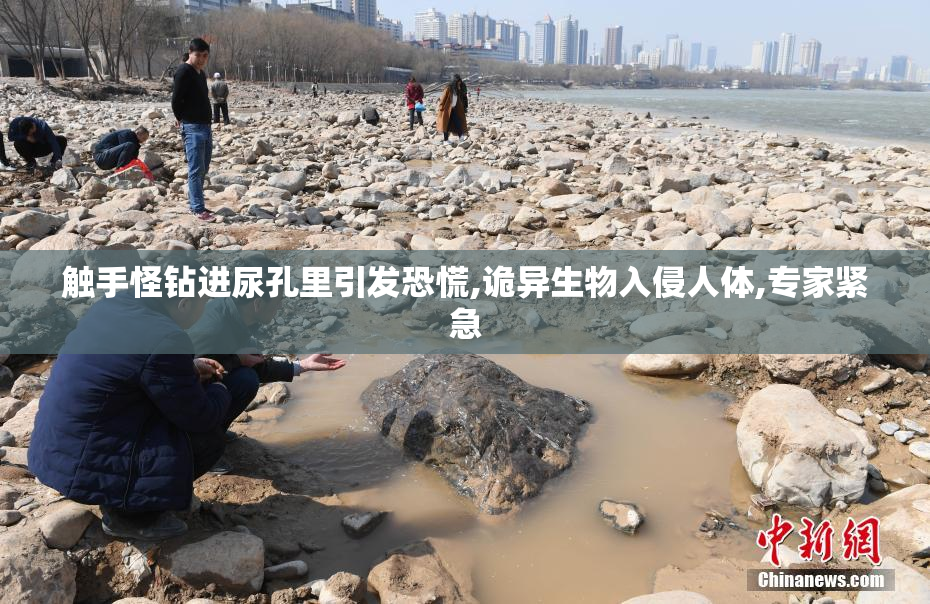 触手怪钻进尿孔里引发恐慌,诡异生物入侵人体,专家紧急