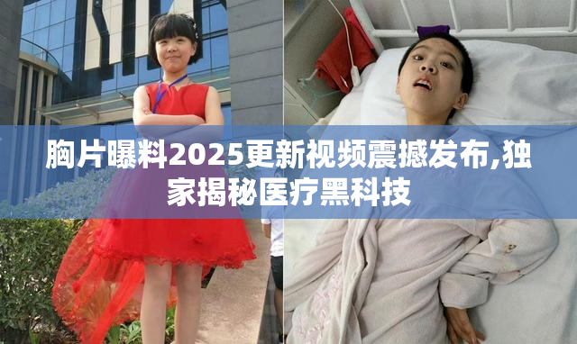 胸片曝料2025更新视频震撼发布,独家揭秘医疗黑科技