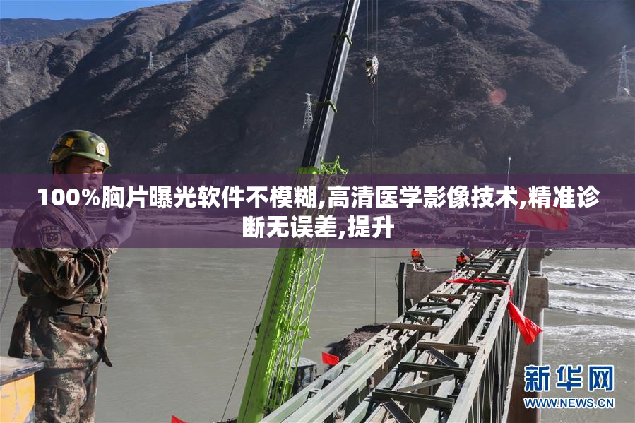100%胸片曝光软件不模糊,高清医学影像技术,精准诊断无误差,提升